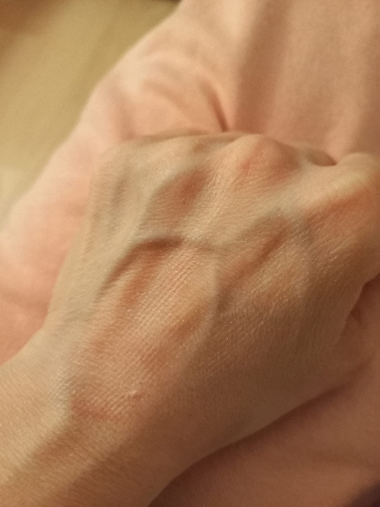 Endlich weniger Haare in der Wohnung